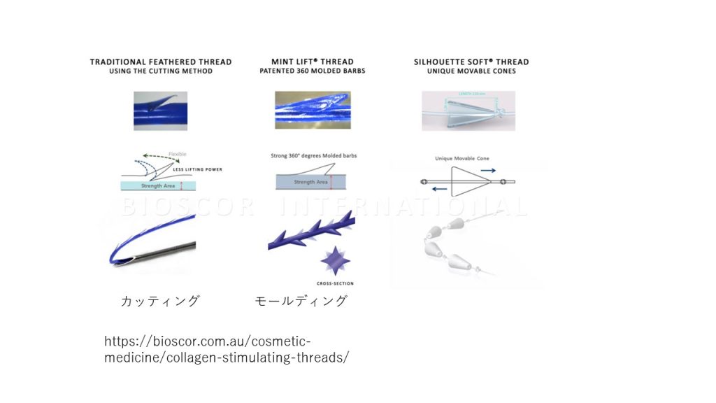 糸リフトの糸の種類について説明。カッティングスレッド｜モールディング｜Nコグ｜ミントリフト｜VOVリフト｜シルエットリフト｜東京上野｜糸リフト専門科｜フィレールクリニック｜PDO｜PCL