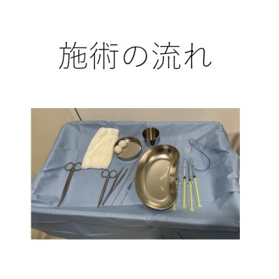 糸リフトの施術の流れ