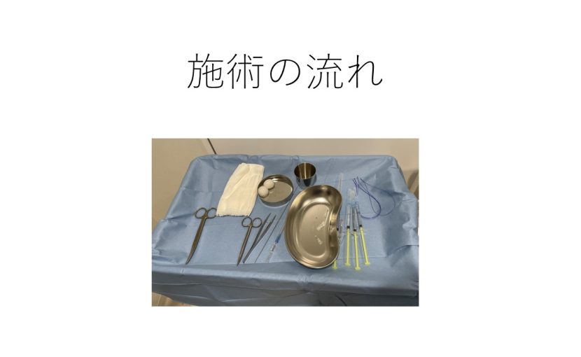 糸リフトの施術の流れ